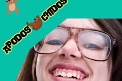 Apodos Feos